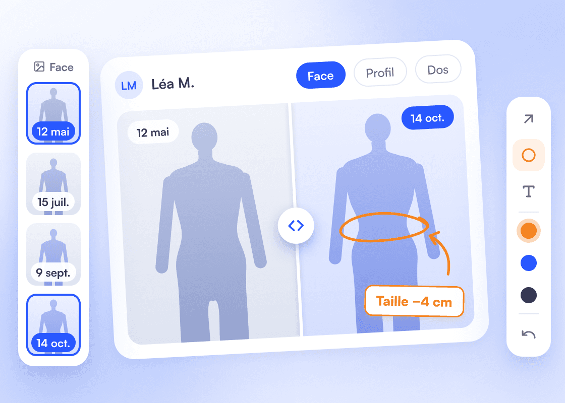 Comparaison avant / après de Léa M. entre le 12 mai et le 14 octobre, pose de face, avec le curseur central et une annotation « Taille −4 cm ».